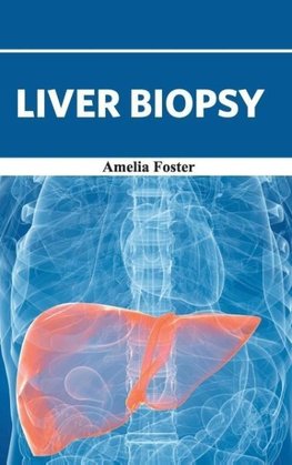 Liver Biopsy