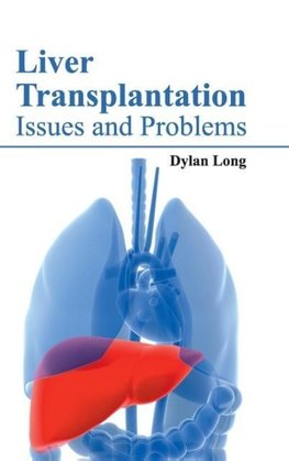 Liver Transplantation