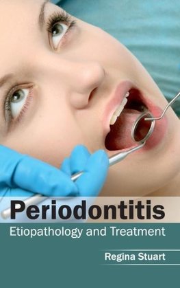 Periodontitis