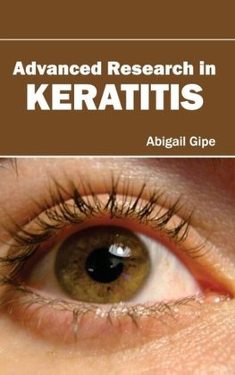 Advanced Research in Keratitis