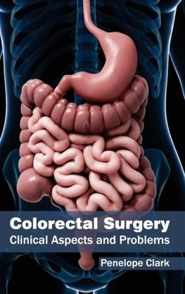 Colorectal Surgery