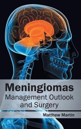 Meningiomas