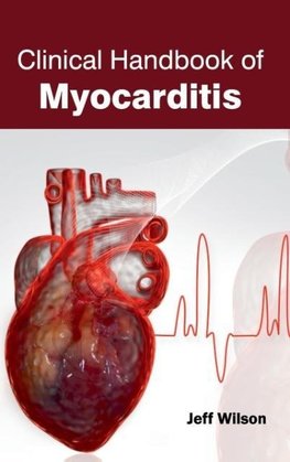 Clinical Handbook of Myocarditis