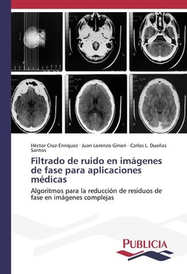 Filtrado de ruido en imágenes de fase para aplicaciones médicas