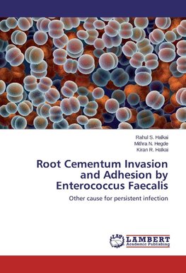 Root Cementum Invasion and Adhesion by Enterococcus Faecalis