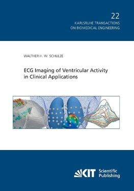 ECG Imaging of Ventricular Activity in Clinical Applications