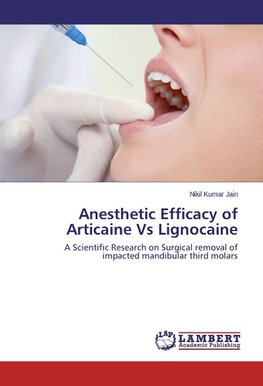 Anesthetic Efficacy of Articaine Vs Lignocaine