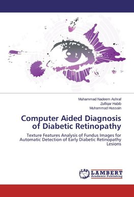 Computer Aided Diagnosis of Diabetic Retinopathy