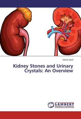 Kidney Stones and Urinary Crystals: An Overview