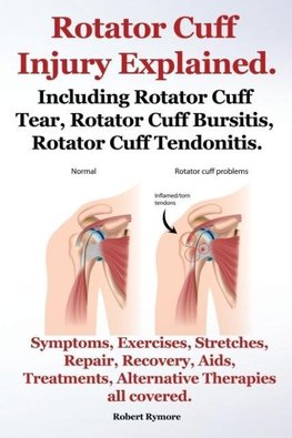 Rymore, R: Rotator Cuff Injury Explained. Including Rotator