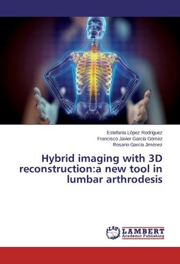 Hybrid imaging with 3D reconstruction:a new tool in lumbar arthrodesis