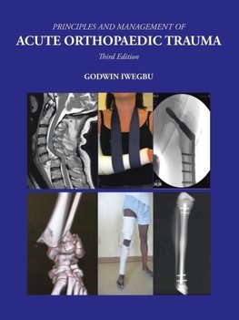 PRINCIPLES AND MANAGEMENT OF ACUTE ORTHOPAEDIC TRAUMA