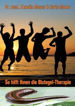 So hilft ihnen die Blutegeltherapie