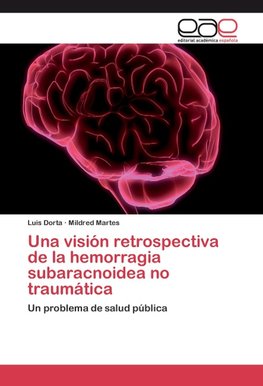 Una visión retrospectiva de la hemorragia subaracnoidea no traumática