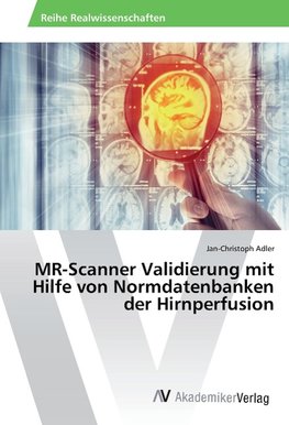 MR-Scanner Validierung mit Hilfe von Normdatenbanken der Hirnperfusion