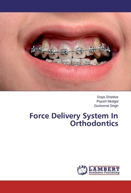 Force Delivery System In Orthodontics