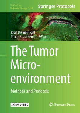 The Tumor Microenvironment