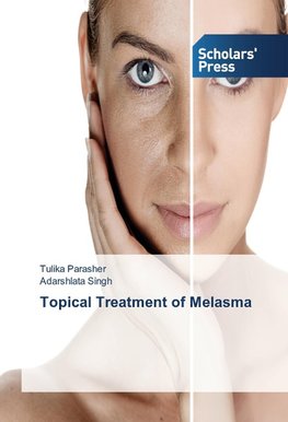 Topical Treatment of Melasma