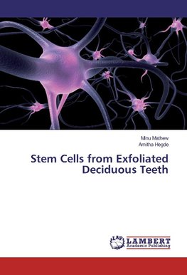 Stem Cells from Exfoliated Deciduous Teeth