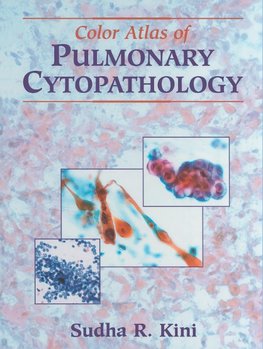 Color Atlas of Pulmonary Cytopathology