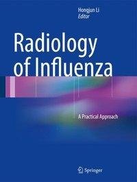 RADIOLOGY OF INFLUENZA 2016/E