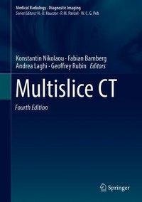 Multislice CT