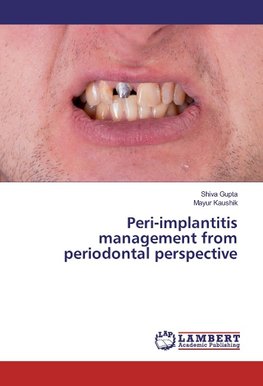 Peri-implantitis management from periodontal perspective