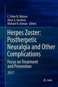 Herpes Zoster and Postherpetic Neuralgia