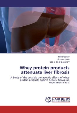 Whey protein products attenuate liver fibrosis