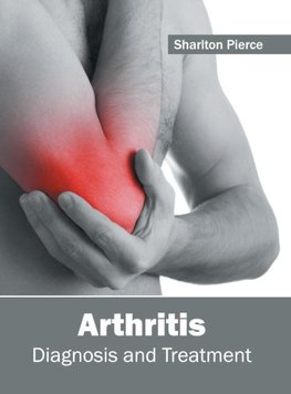 Arthritis