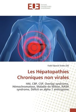 Les Hépatopathies Chroniques non virales