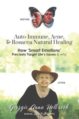 Auto-Immune, Acne, & Rosacea Natural Healing - How 'Smart Emotions' Precisely Target Life's Issues & Why