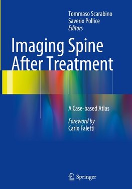 Imaging Spine After Treatment