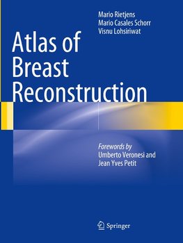 Atlas of Breast Reconstruction