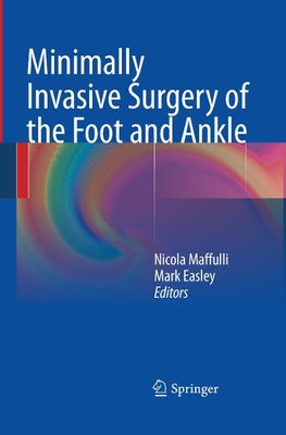 Minimally Invasive Surgery of the Foot and Ankle