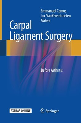 Carpal Ligament Surgery