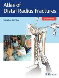 Atlas of Distal Radius Fractures