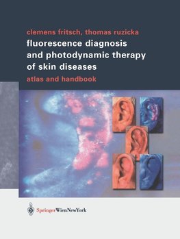 Fluorescence Diagnosis and Photodynamic Therapy of Skin Diseases