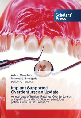 Implant Supported Overdenture: an Update