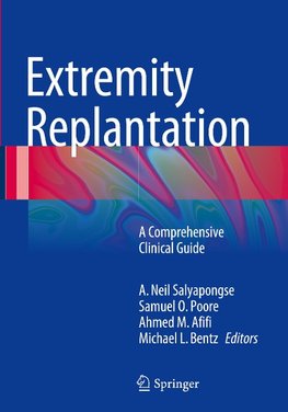 Extremity Replantation