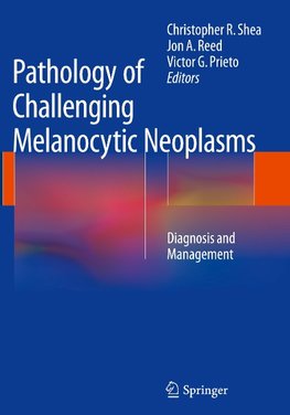 Pathology of Challenging Melanocytic Neoplasms