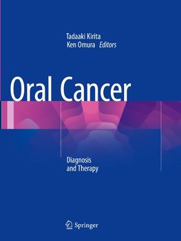 Oral Cancer