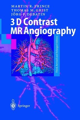 3D Contrast MR Angiography