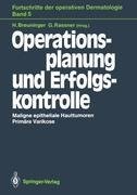 Operationsplanung und Erfolgskontrolle