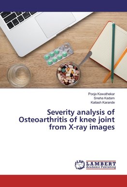 Severity analysis of Osteoarthritis of knee joint from X-ray images