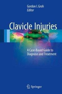 Clavicle Injuries