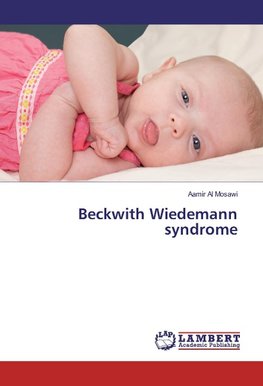 Beckwith Wiedemann syndrome