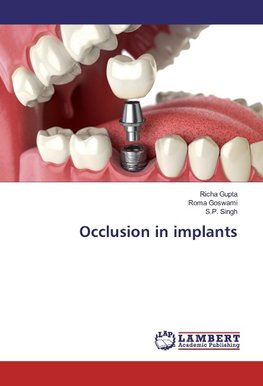 Occlusion in implants