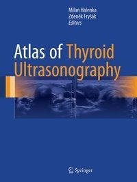 Atlas of Thyroid Ultrasonography