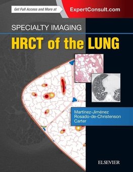 Specialty Imaging: HRCT of the Lung